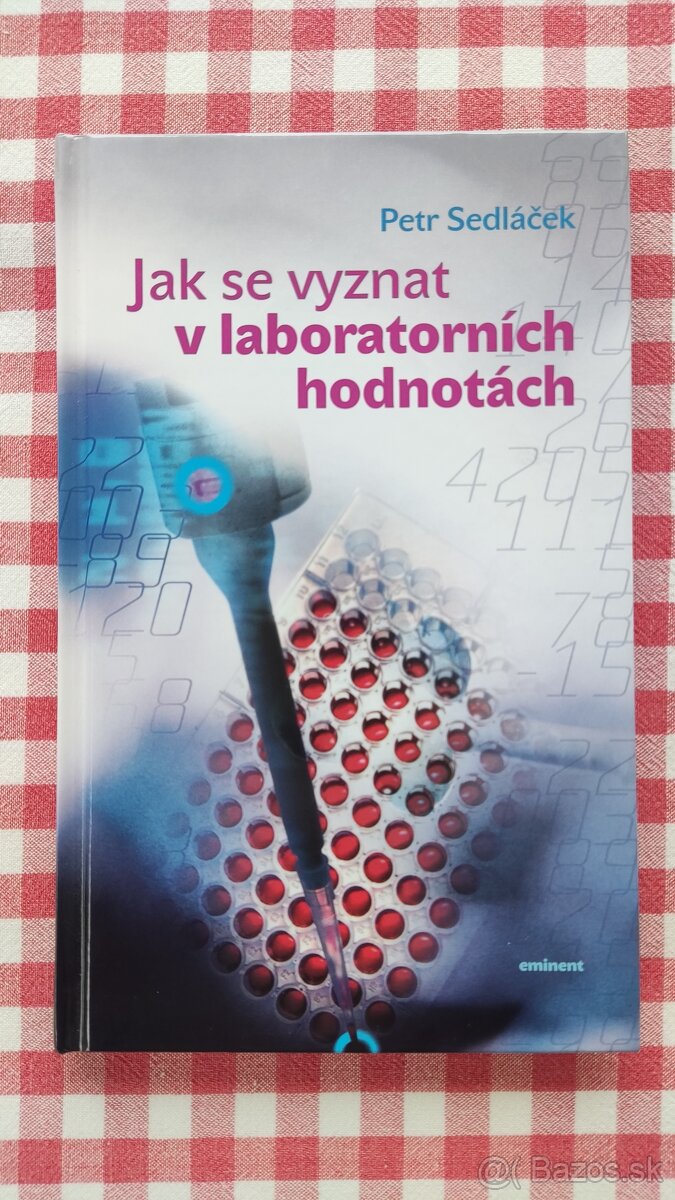 Ako sa vyznať v laboratórnych hodnotách