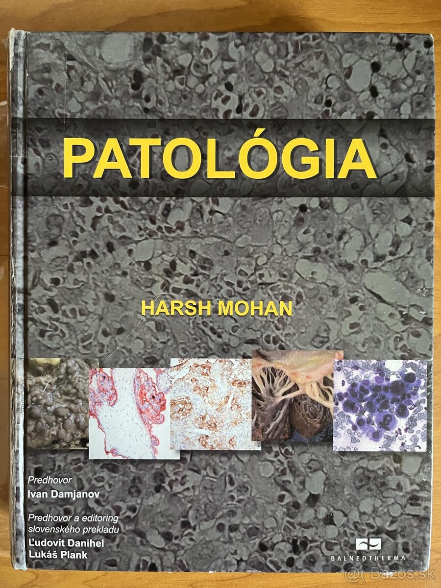 Patologia Mohan