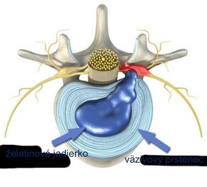 Predám MAGNETOTERAPIA KRUH BIOTORUS LT 100 - 13