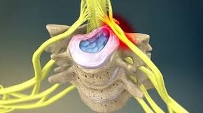 Predám MAGNETOTERAPIA BIOTORUS plus ULTICARE. - 13