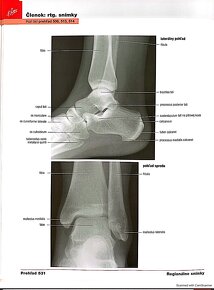 PDF - Netterov anatomický atlas človeka 6. vydanie SK - 14