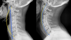 Predám MAGNETOTERAPIA BIOTORUS plus ULTICARE. - 18