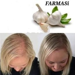 Cesnakový šampón maska Farmasi - 2