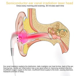 Tinitus liečba - 2