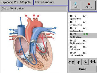 Rayonex Raycomp PS 1000 Biorezonančný prístroj - 3