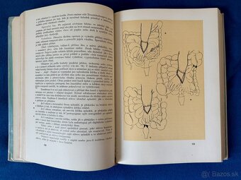 Kniha medicína: Operace náhlých příhod břišních - 4