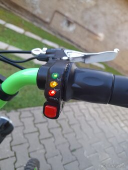 Elektrická kolobežka 1000W (XSCOOTERS) - 4