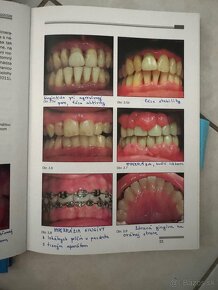 Knihy - dentálna hygiena č. II. a III, IV, V, VI - 4