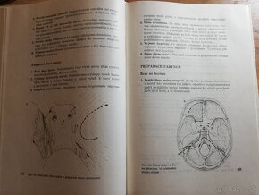 Malinovský - Anatomická pitva - 5