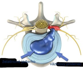 Predám MAGNETOTERAPIA BIOTORUS plus ULTICARE. - 5