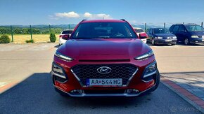 Hyundai Kona 1.0 T-GDi 2018 Xpossible - 5