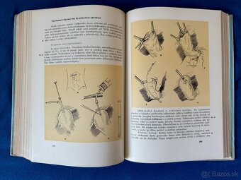 Kniha medicína: Operace náhlých příhod břišních - 6