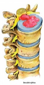 Predám MAGNETOTERAPIA BIOTORUS plus ULTICARE. - 6