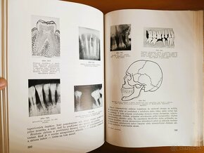 Zubná Protetika (1952) - 6