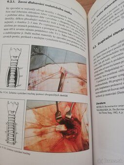 Praktická chirurgia trachey - 7