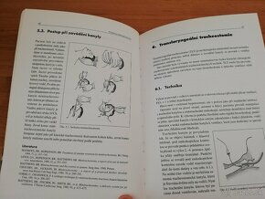 P.Pafko, S.Haruštiak - Praktická chirurgia trachey - 9